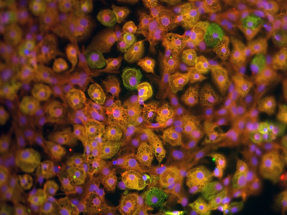 Differentiated adipocytes (PA6 cell line), light microscopy. Round lipid-laden cells with cytoplasm compressed to a thin rim around the central lipid droplet, demonstrating the characteristic unilocular morphology of the white adipocyte.